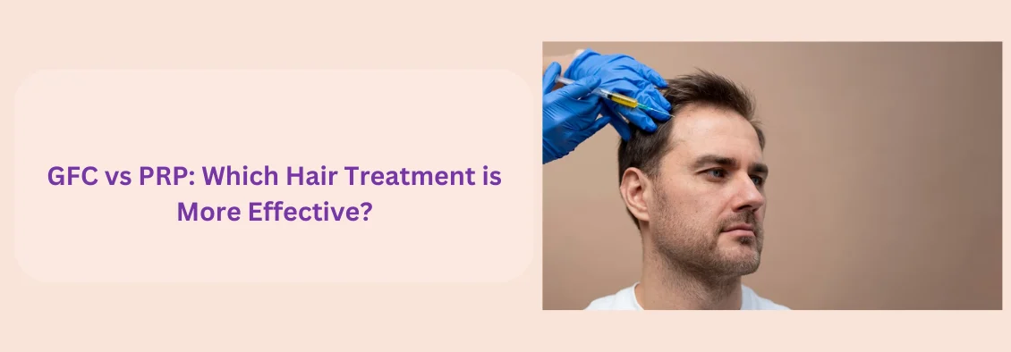 GFC vs PRP hair treatments